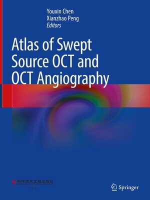 cover image of Atlas of Swept Source OCT and OCT Angiography